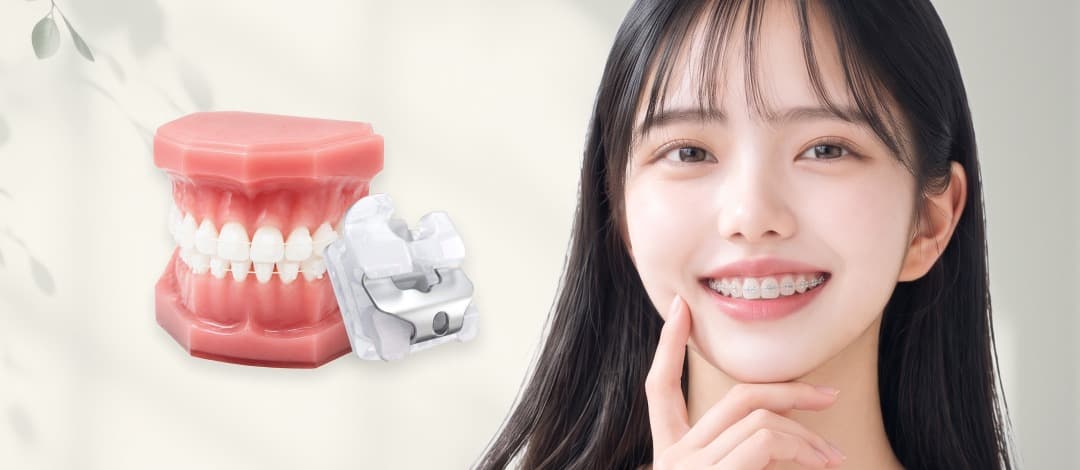 Self-ligating Orthodontic S-line