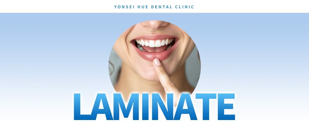 Laminate