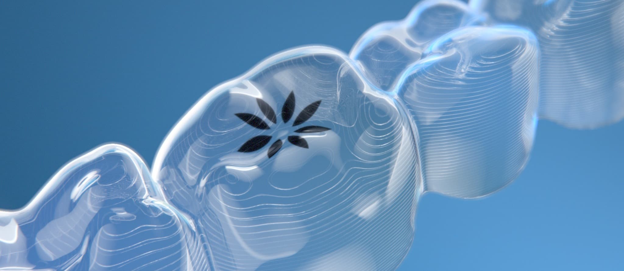 Digital orthodontics, Invisalign