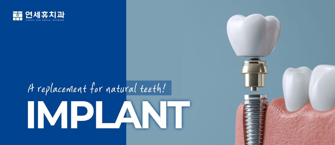 Dental implant