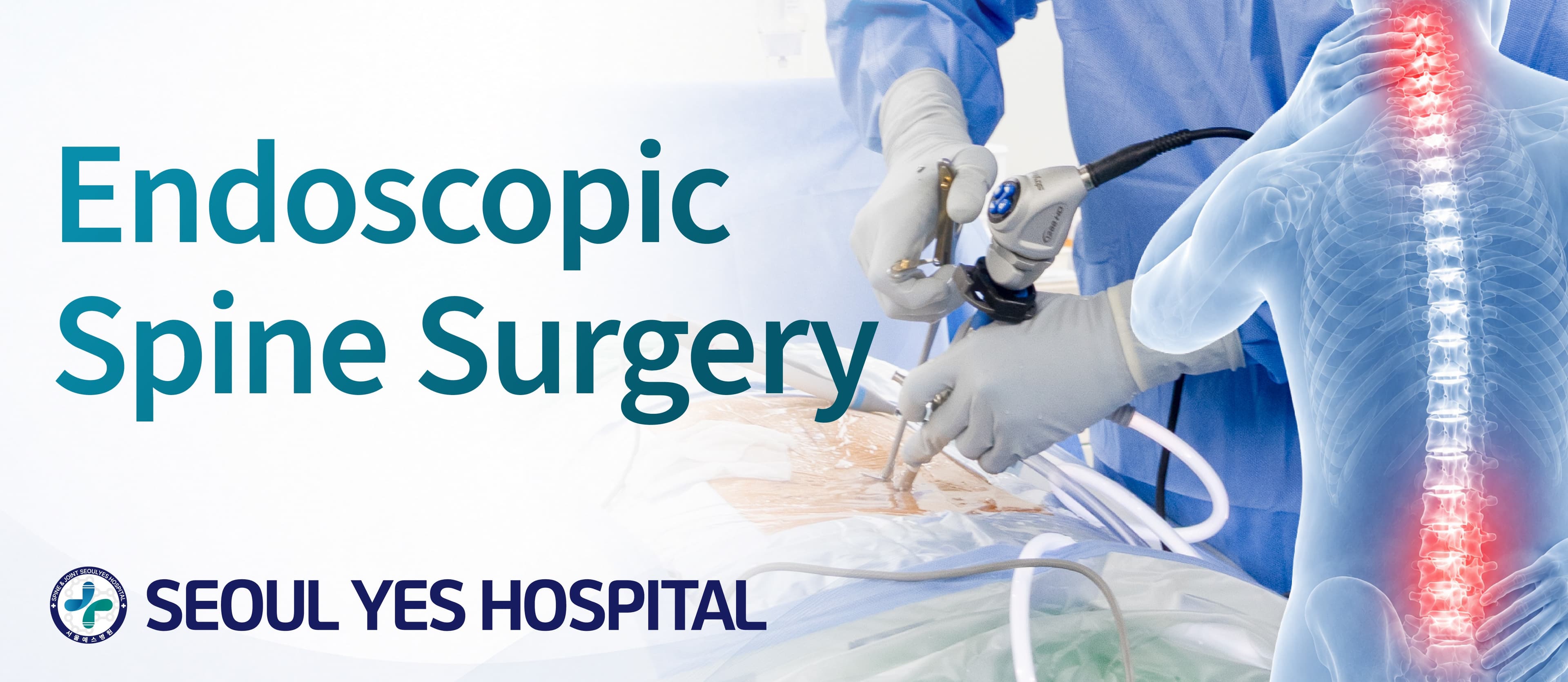 Spinal endoscopic surgery