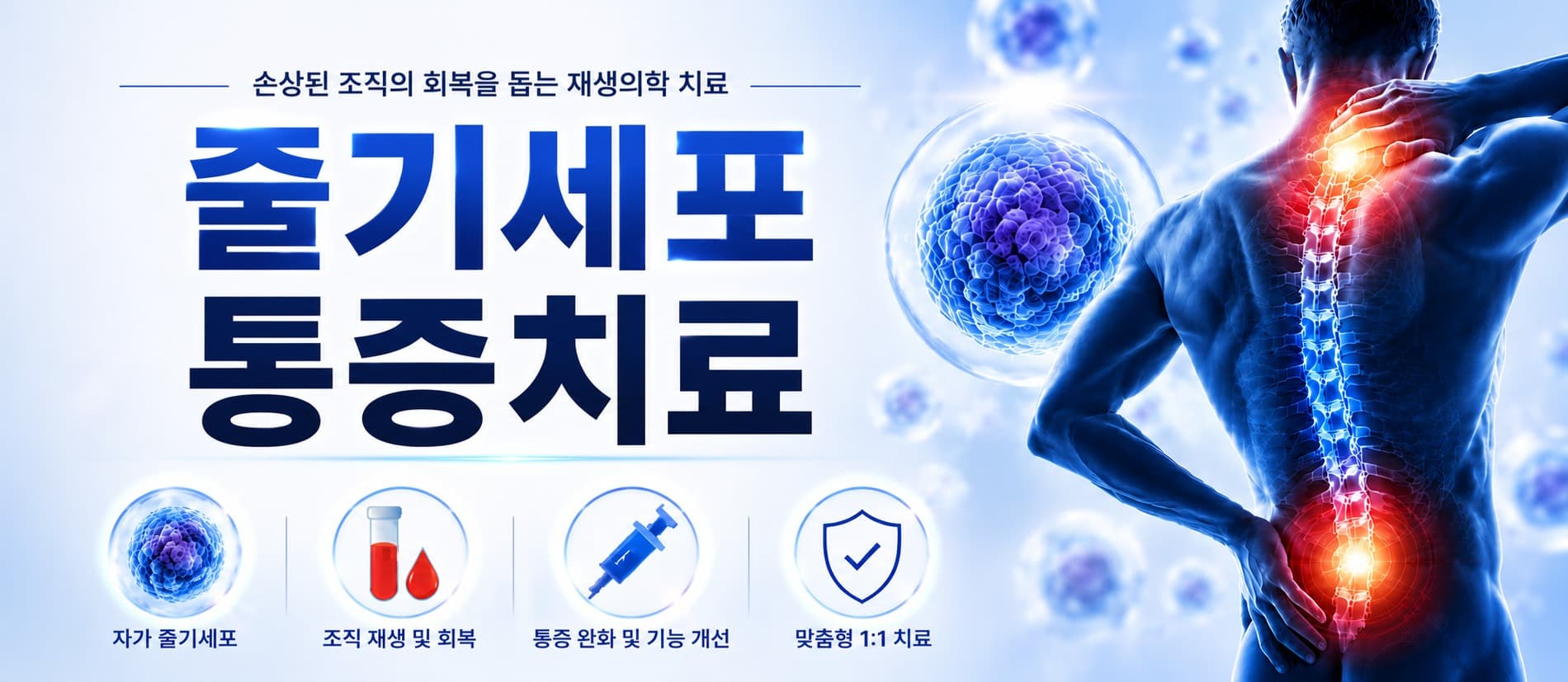 줄기세포 PRF