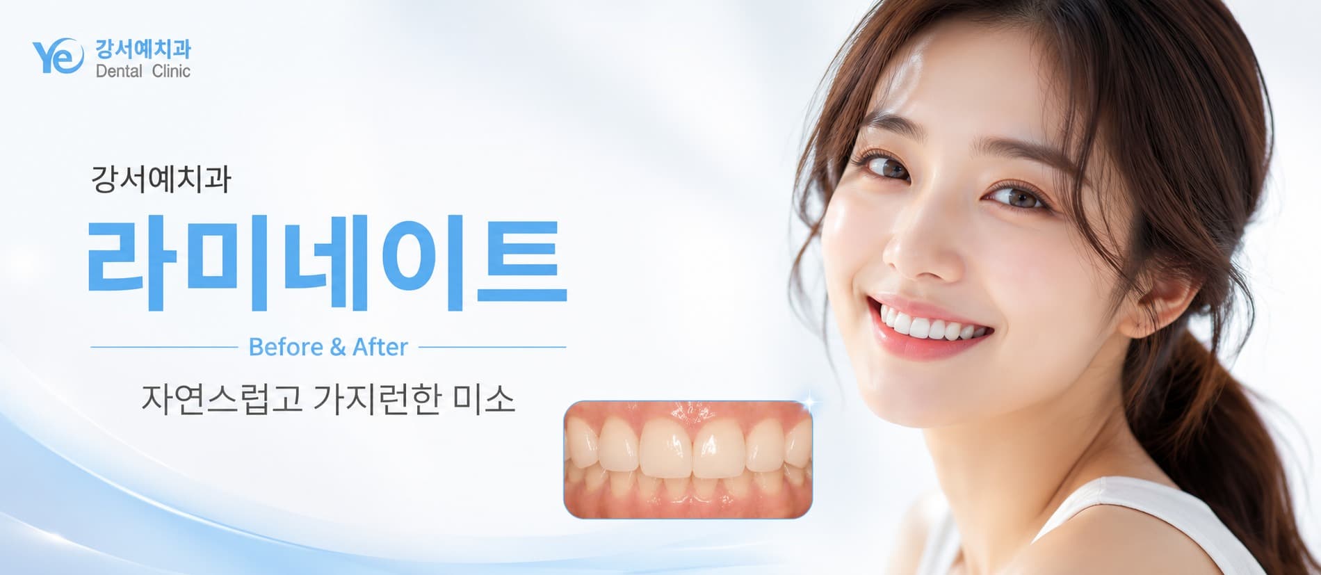 라미네이트