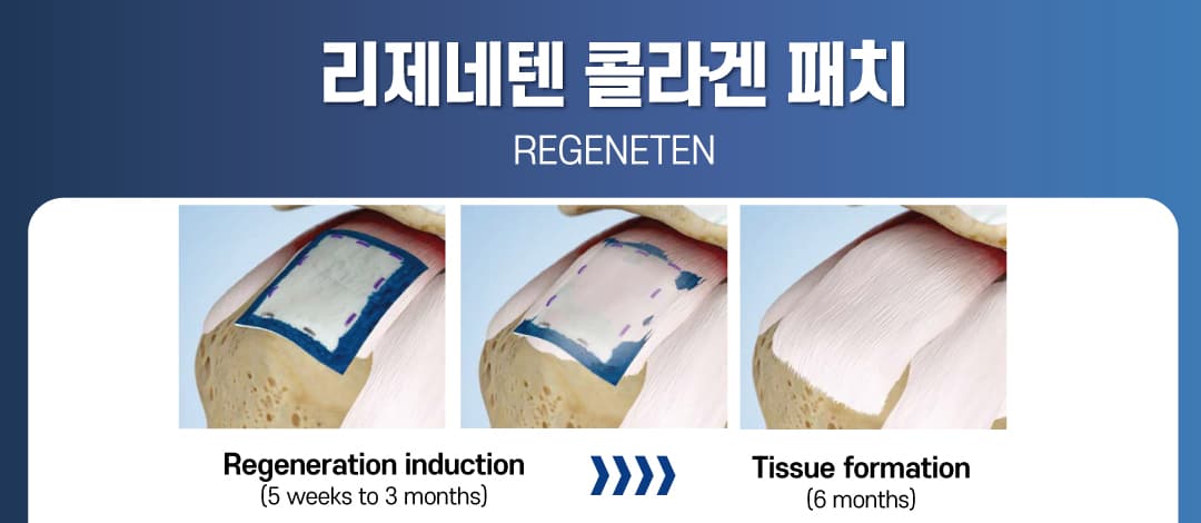 상세 정보