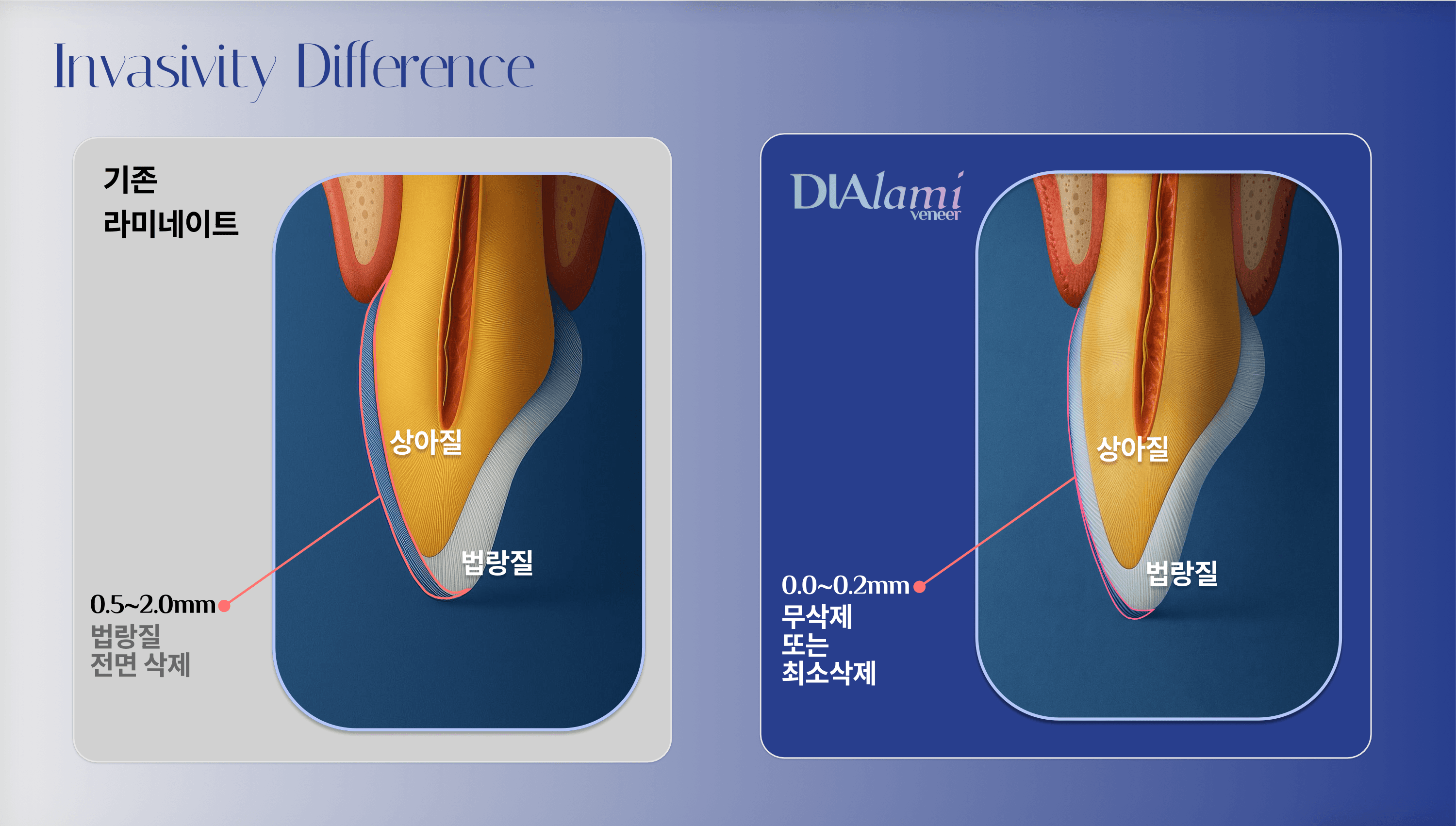 상세 정보