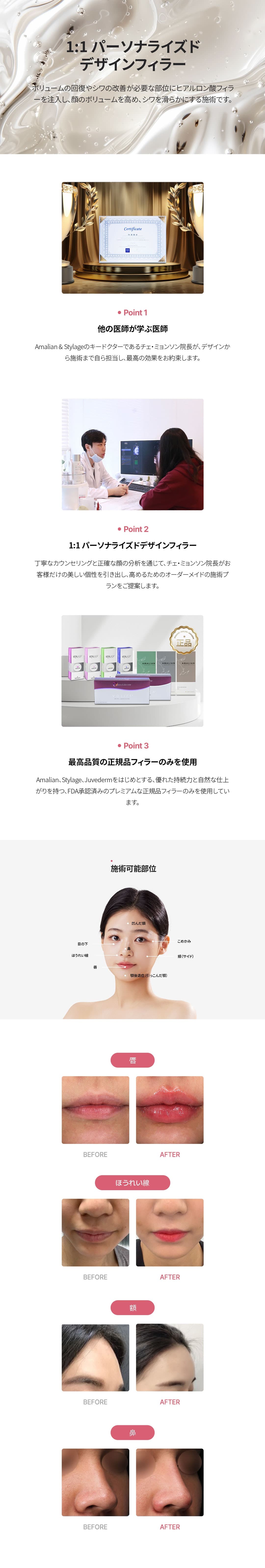 詳細情報