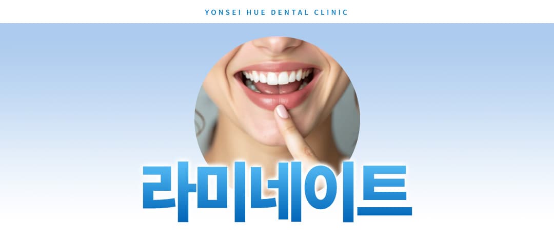 상세 정보