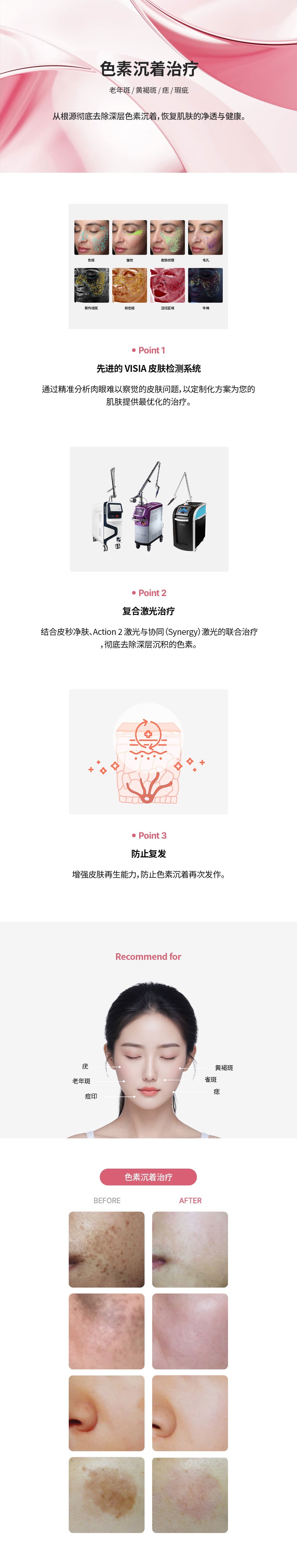 详细信息