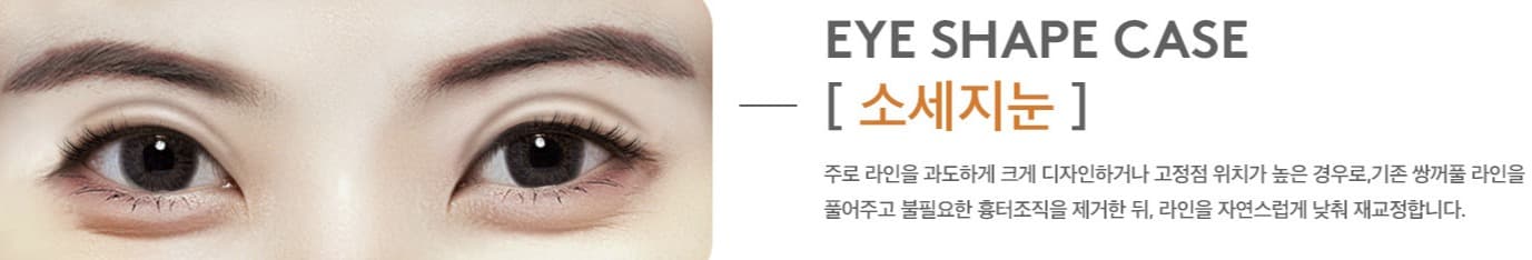 상세 정보