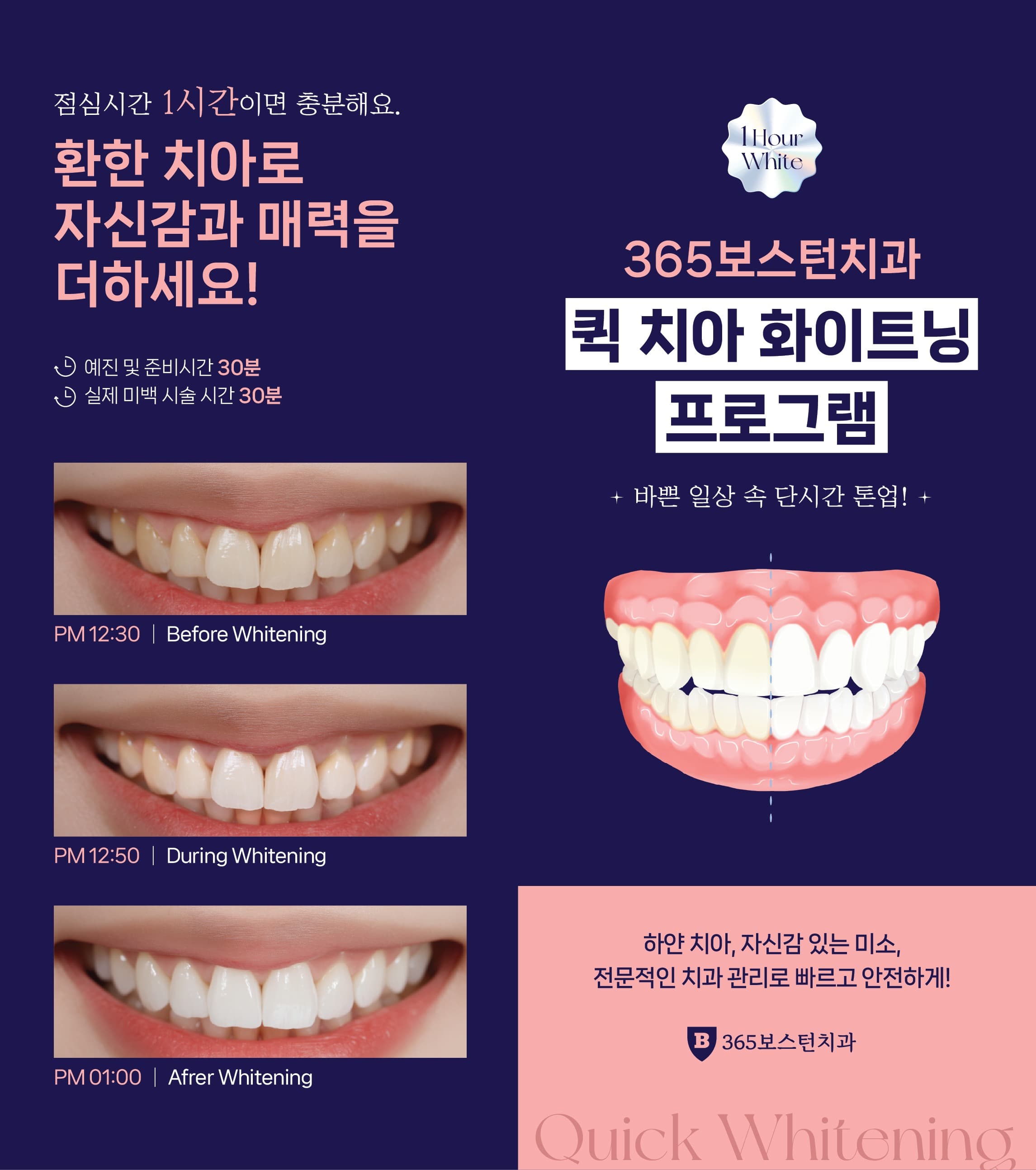상세 정보