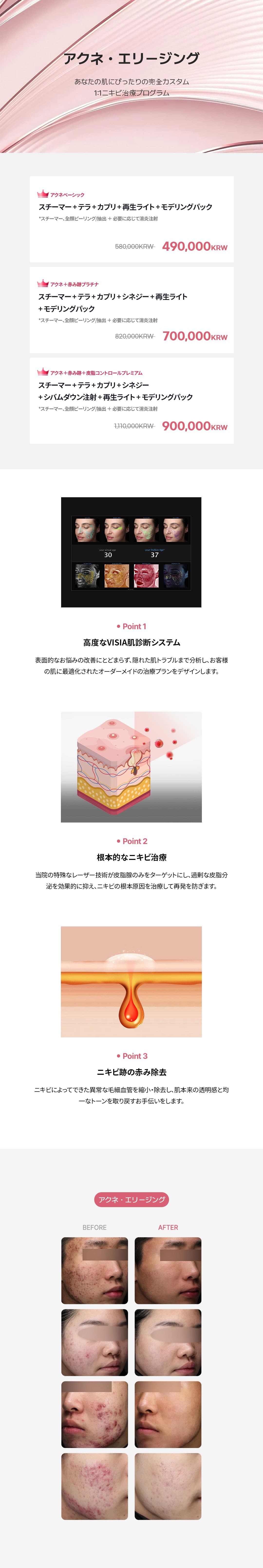 詳細情報