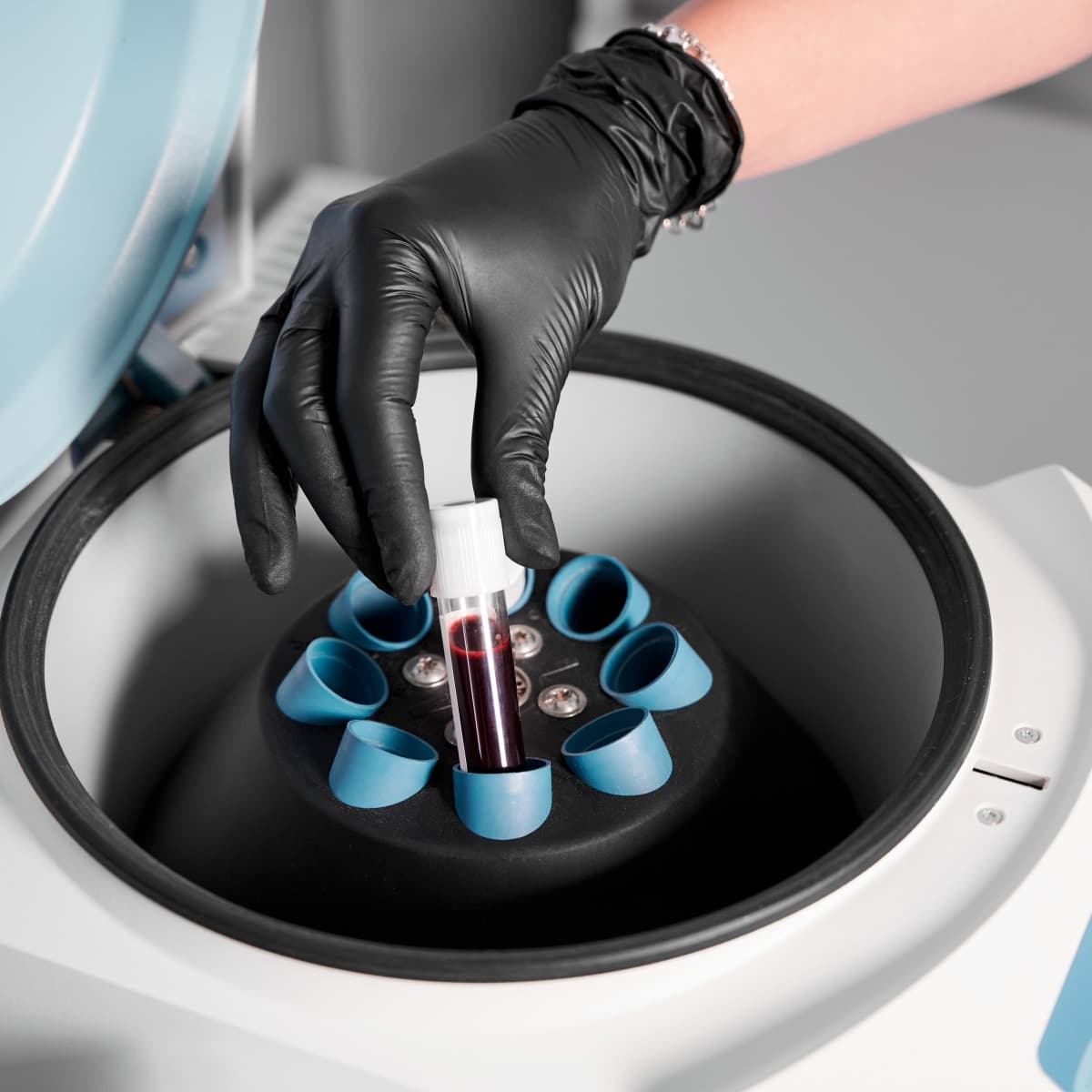 Autologous Platelet-Rich Fibrin (PRF)