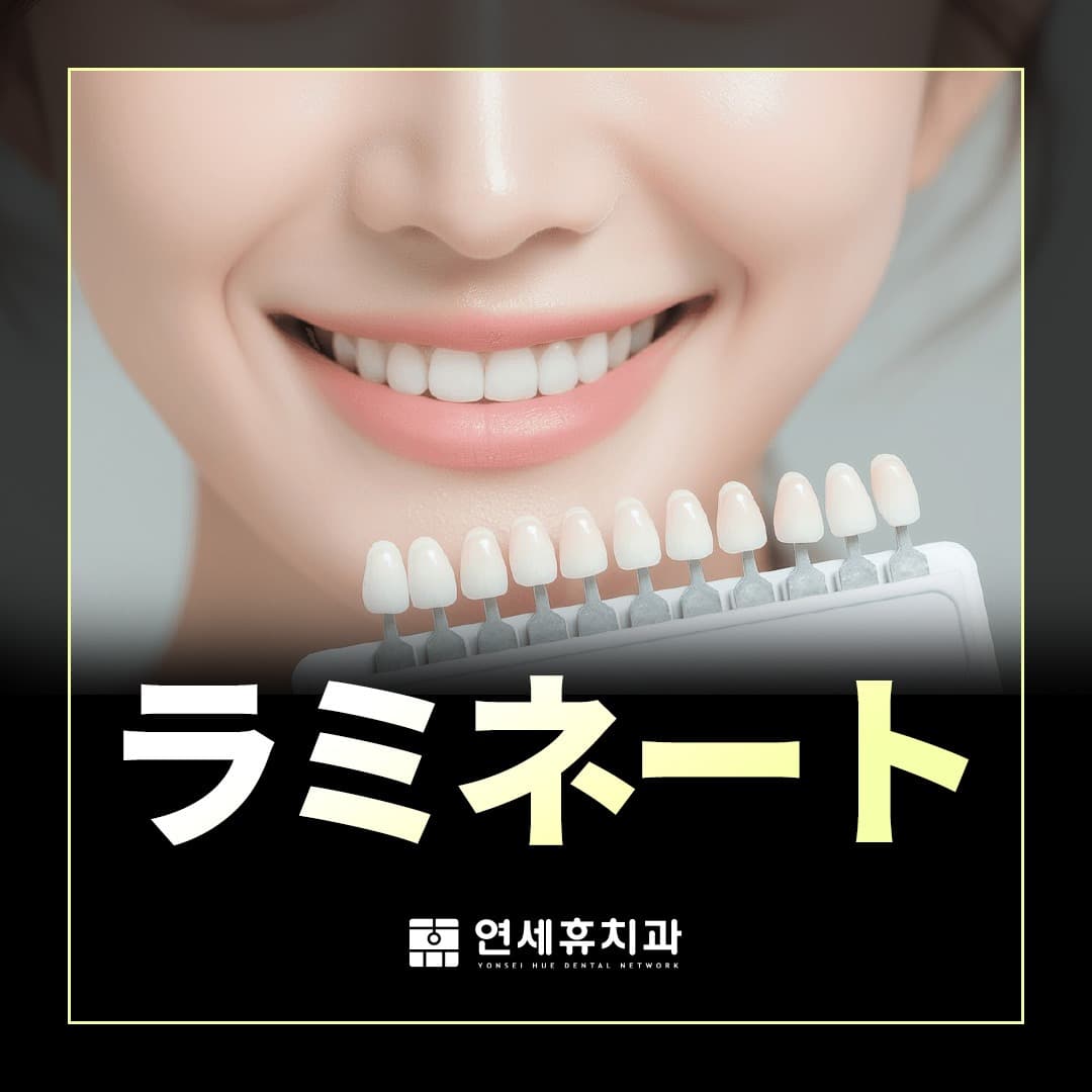 ラミネート