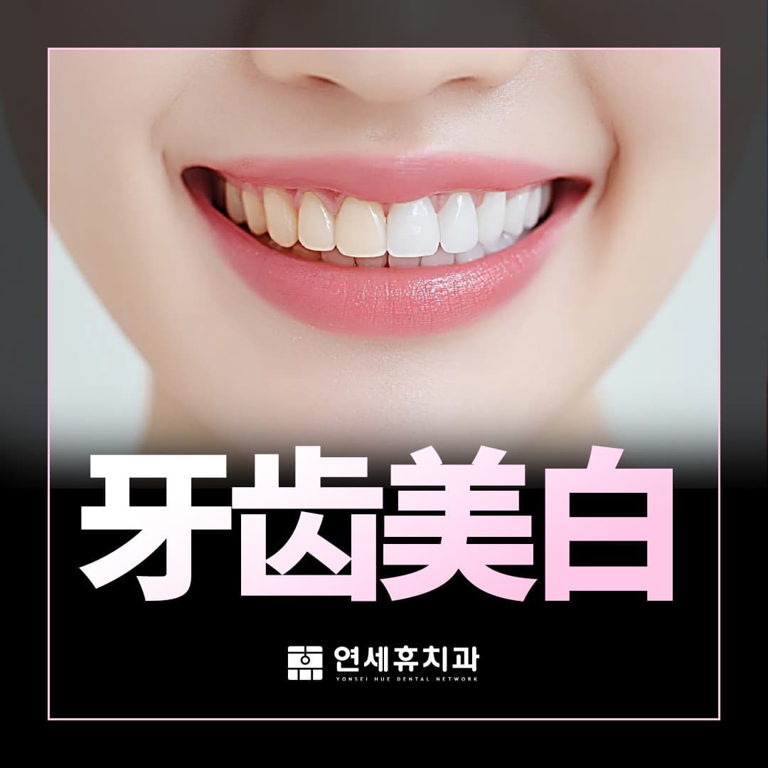 牙齒美白
