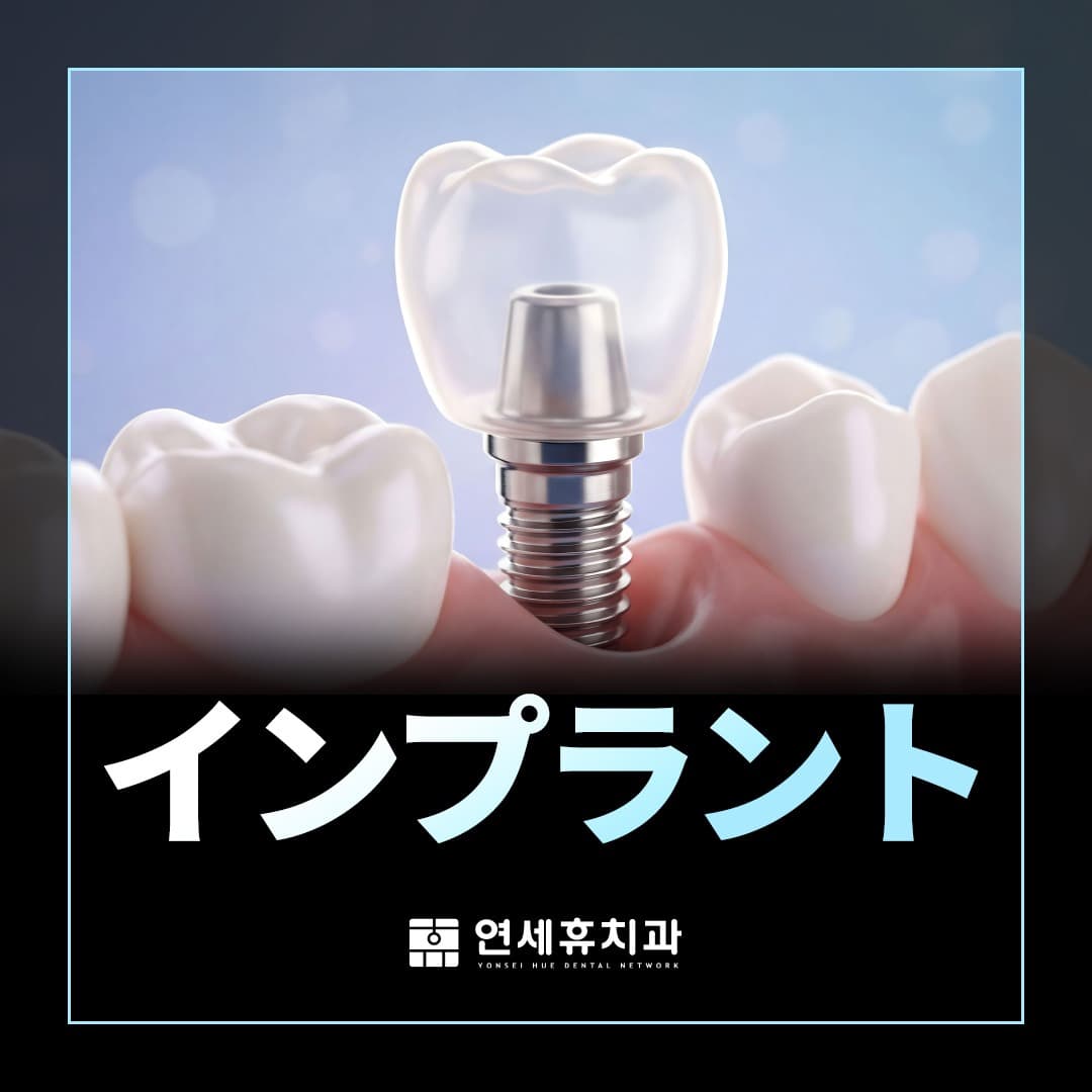 オーダーメイドインプラント