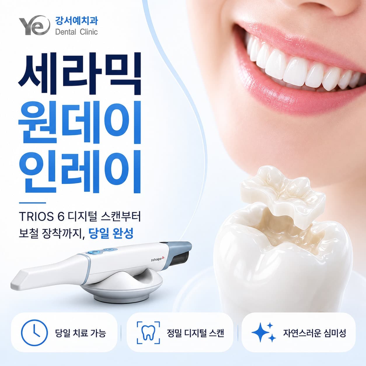 세라믹 원데이 인레이
