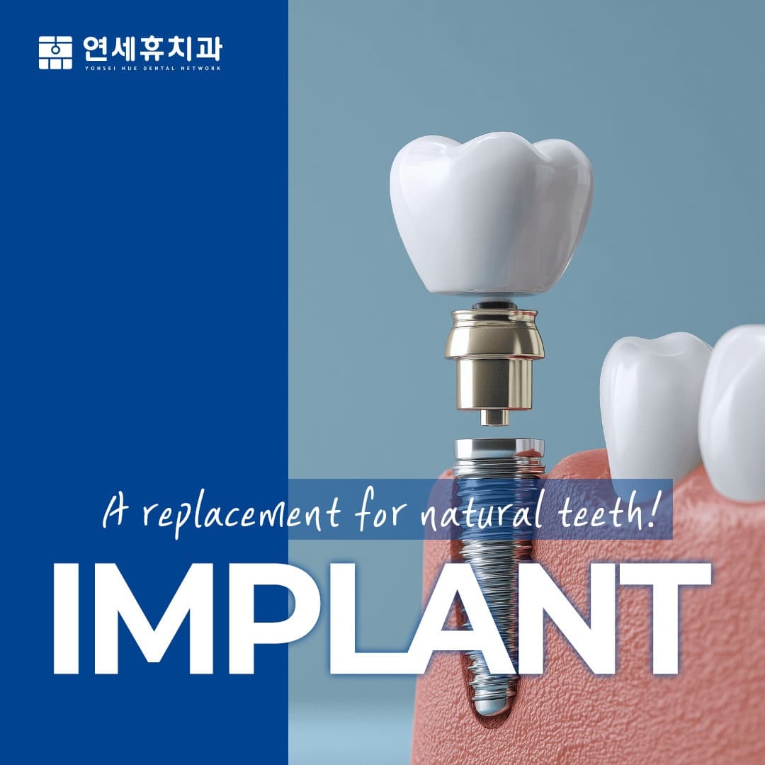 Dental implant