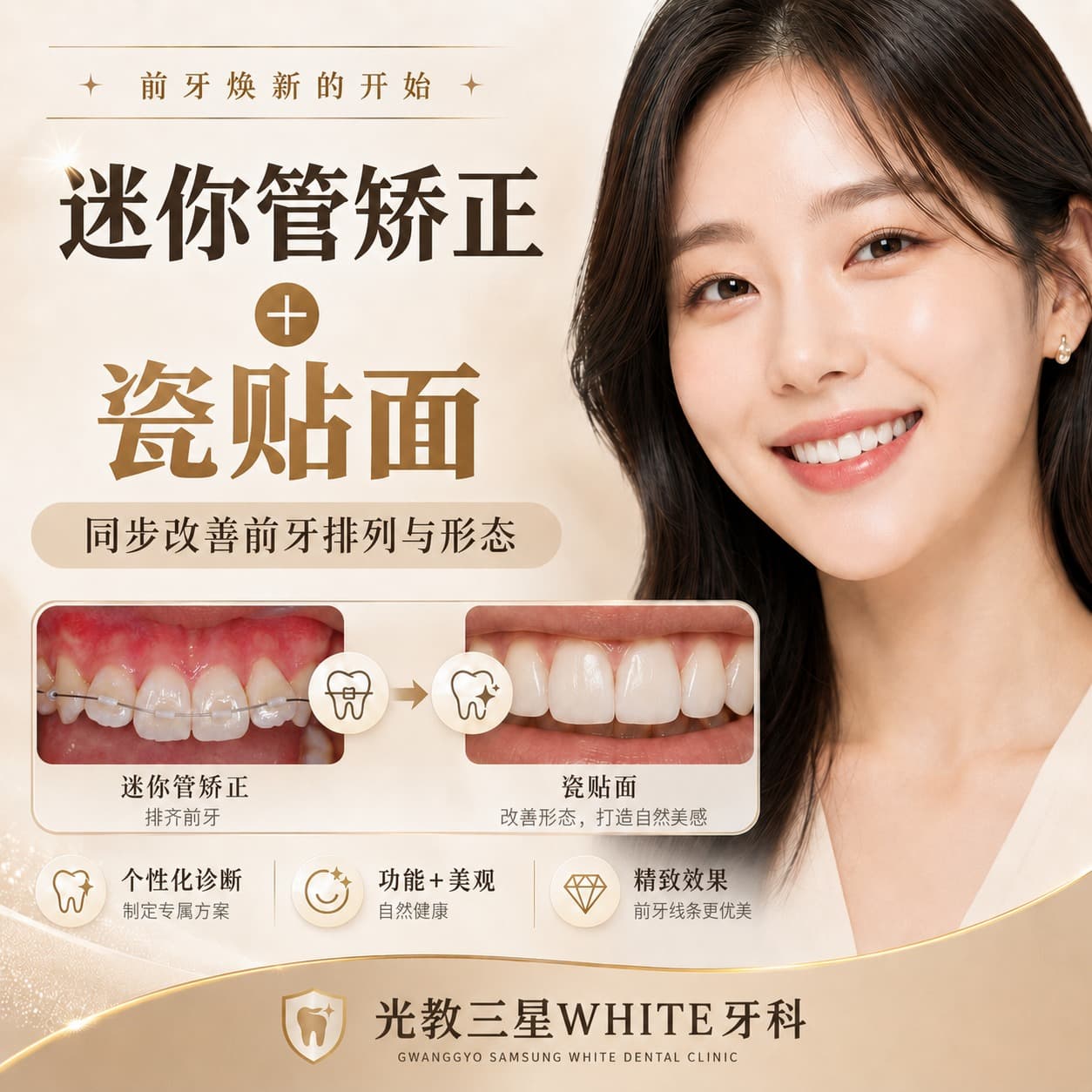 24小时 层叠术