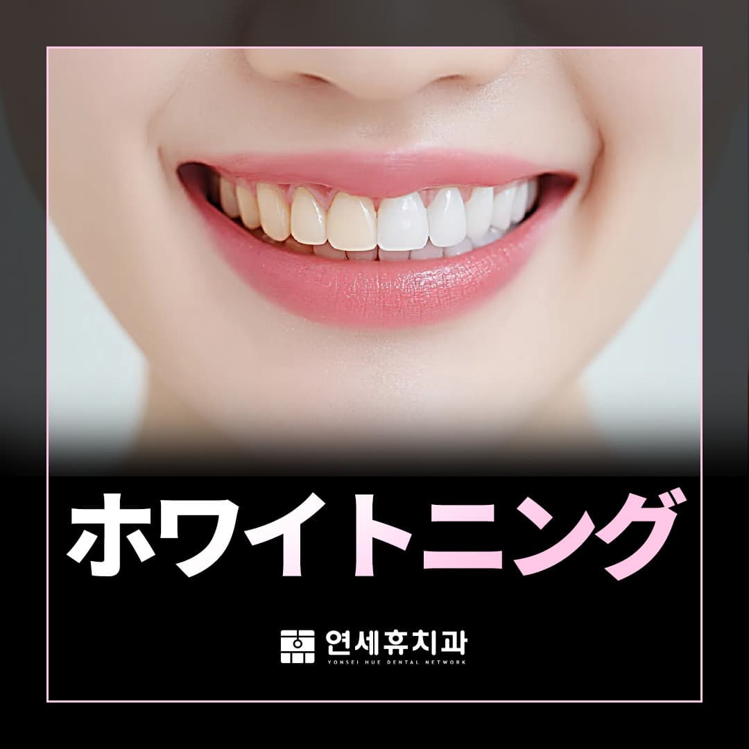 ホワイトニング