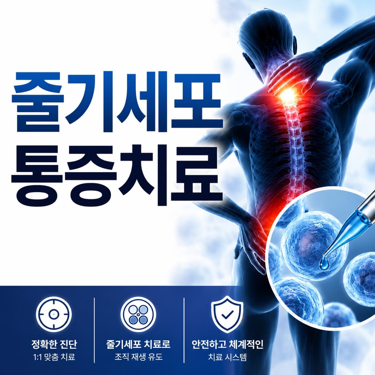 줄기세포 PRF