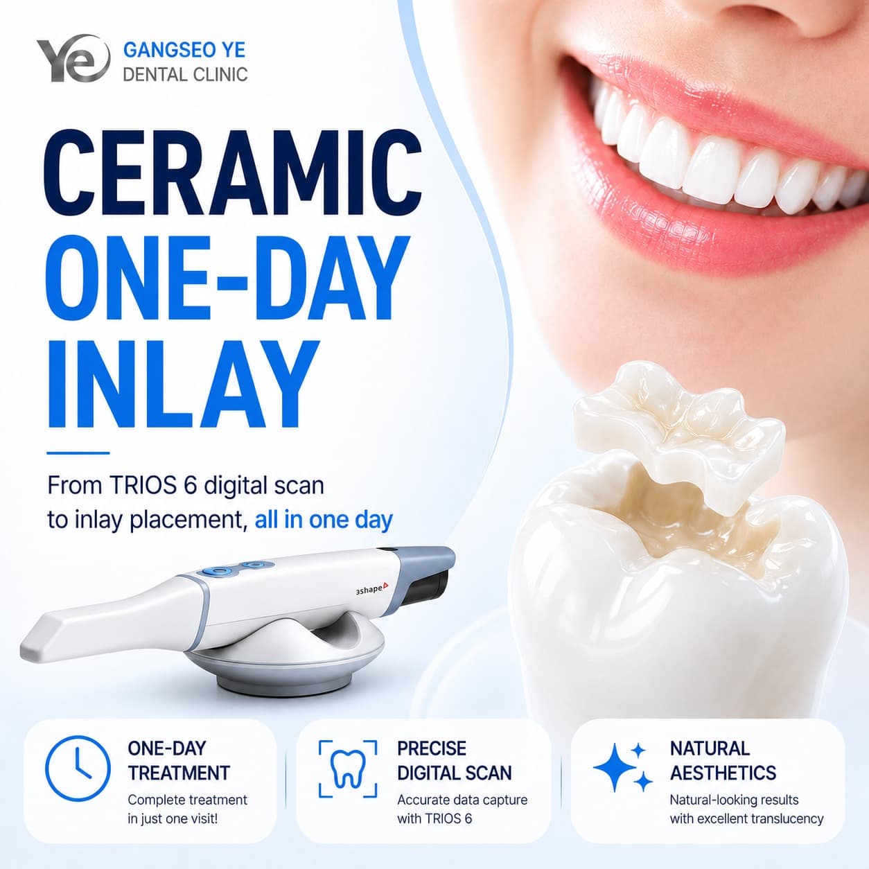 Ceramic one-day inlay