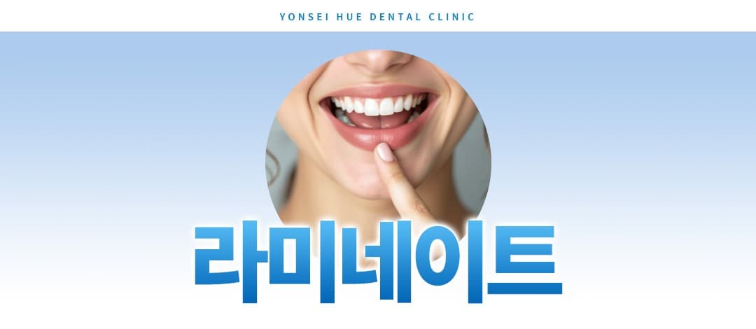 라미네이트