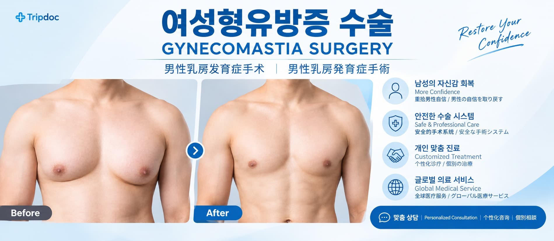 여성형유방증 수술