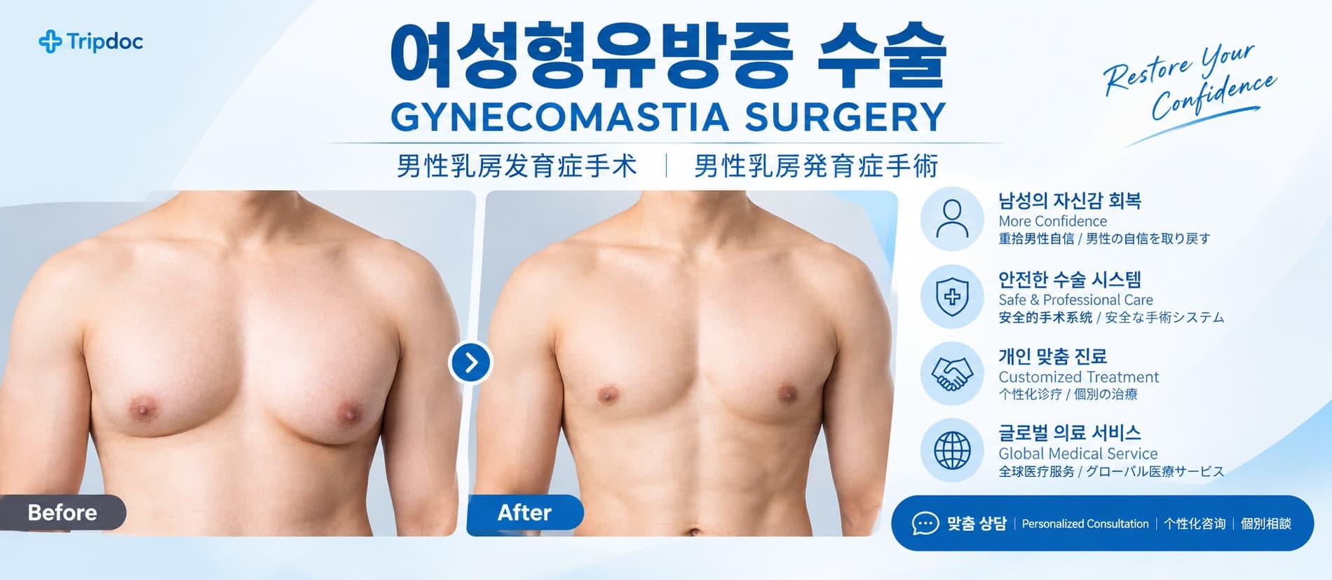 男性乳房发育症手术