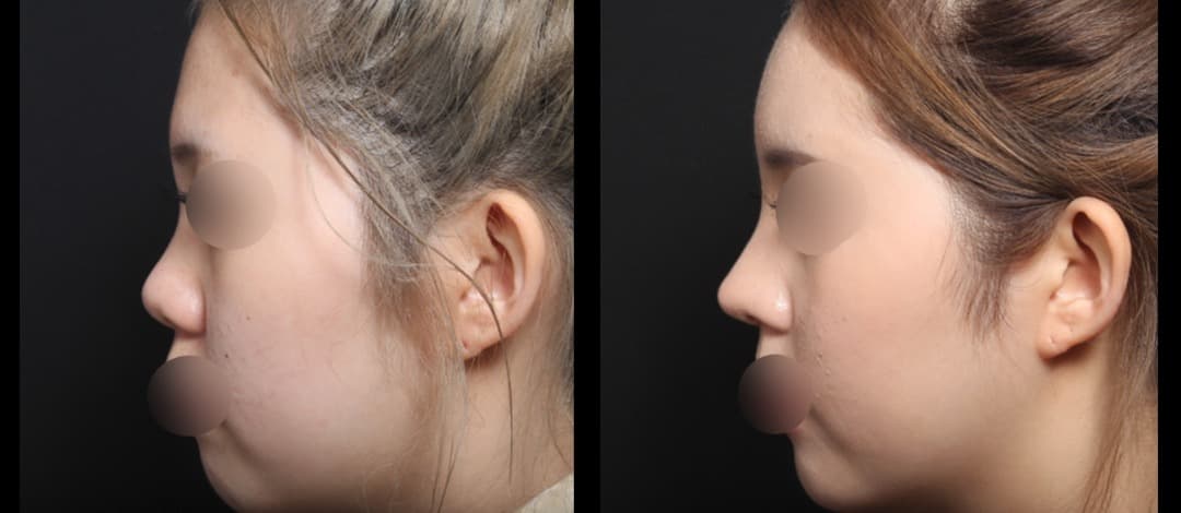 ahn plastic surgery 3