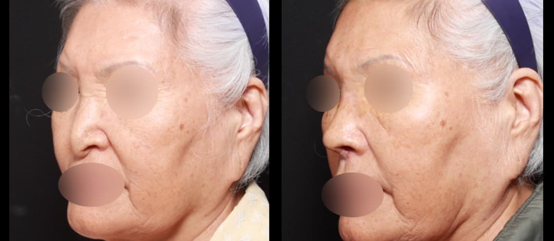ahn plastic surgery 5