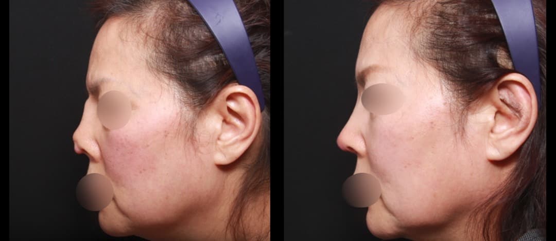 ahn plastic surgery 2