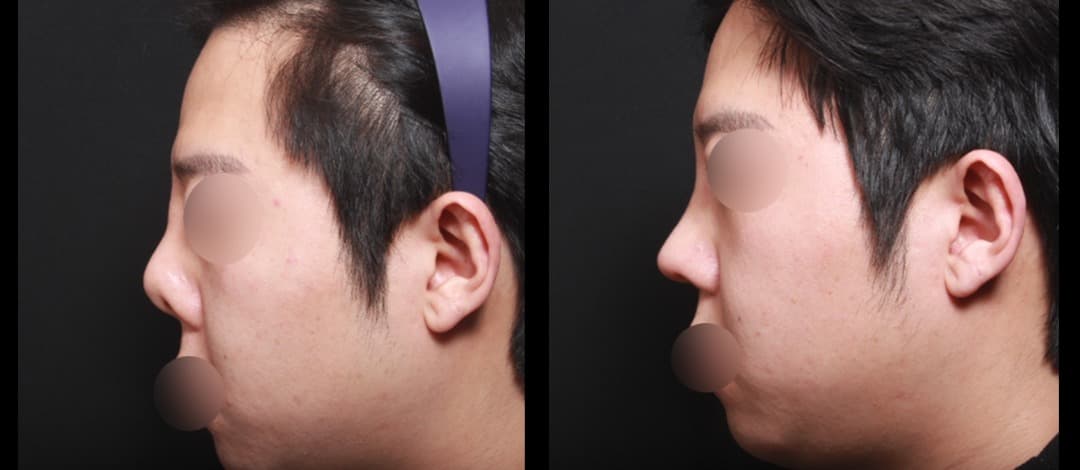 ahn plastic surgery 1