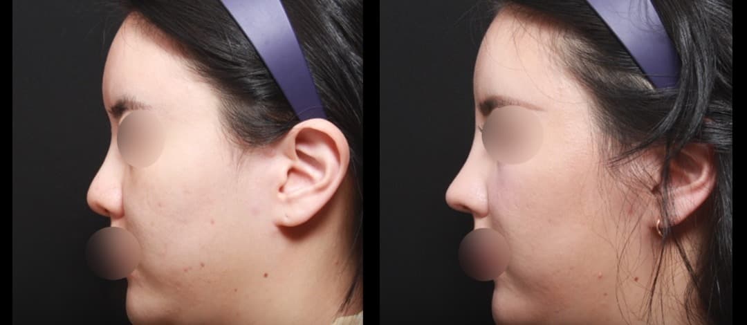 ahn plastic surgery 4