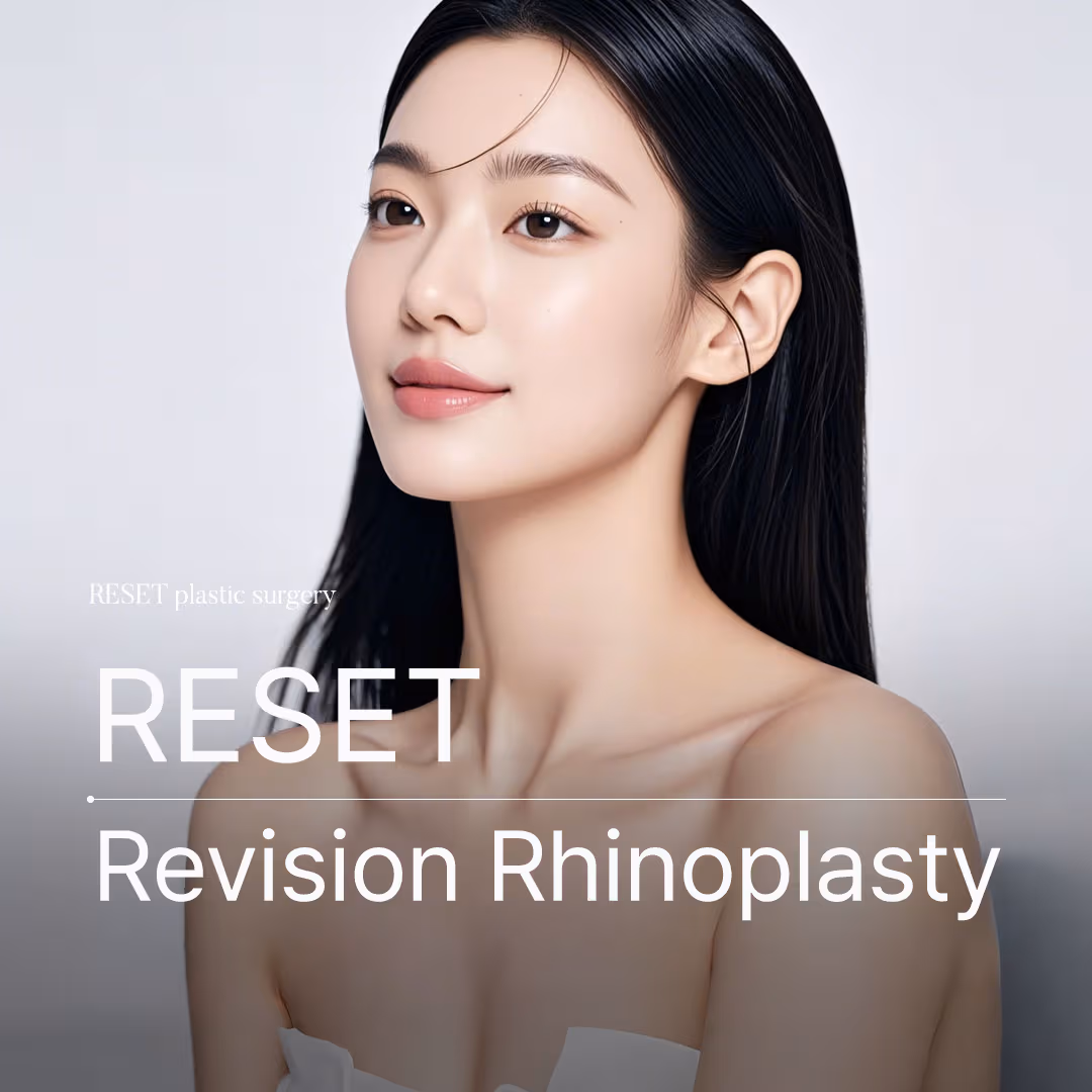 Revision rhinoplasty after a failed primary rhinoplasty