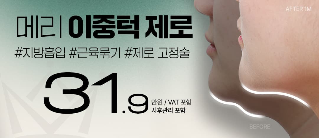 메리 이중턱 제로
