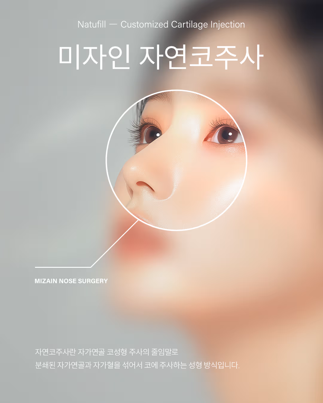 자연코주사
