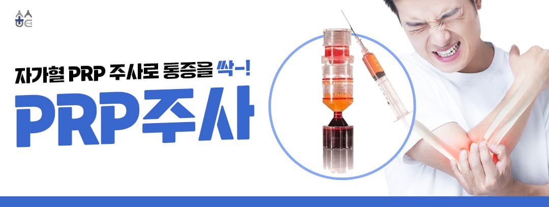 PRP (Platelet-Rich Plasma Therapy)