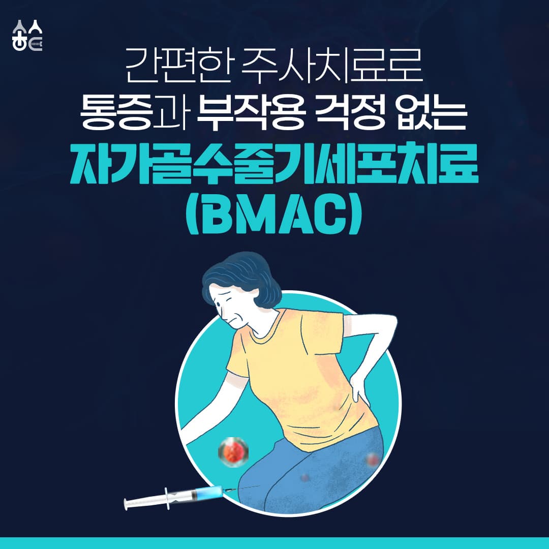 BMAC(自家骨髄濃厚血漿治療術)