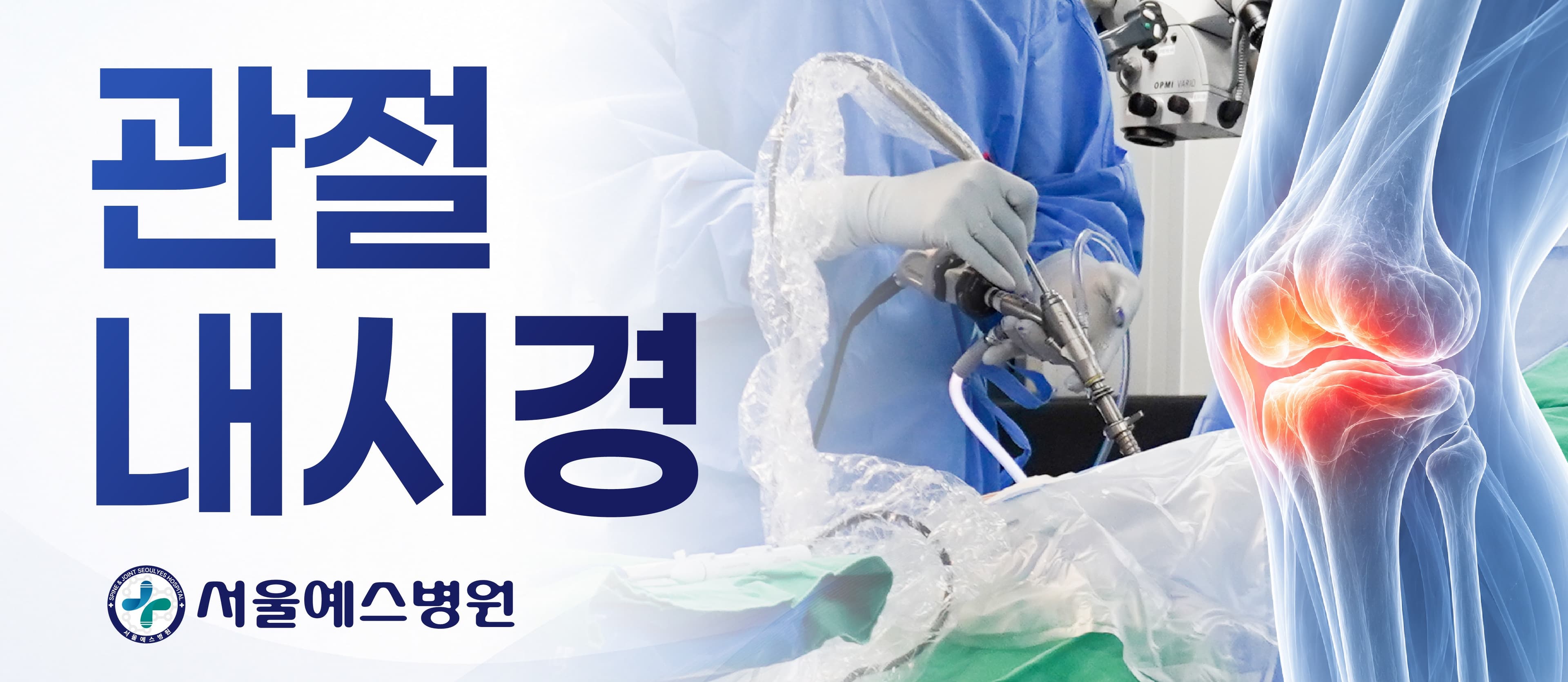 관절내시경 수술