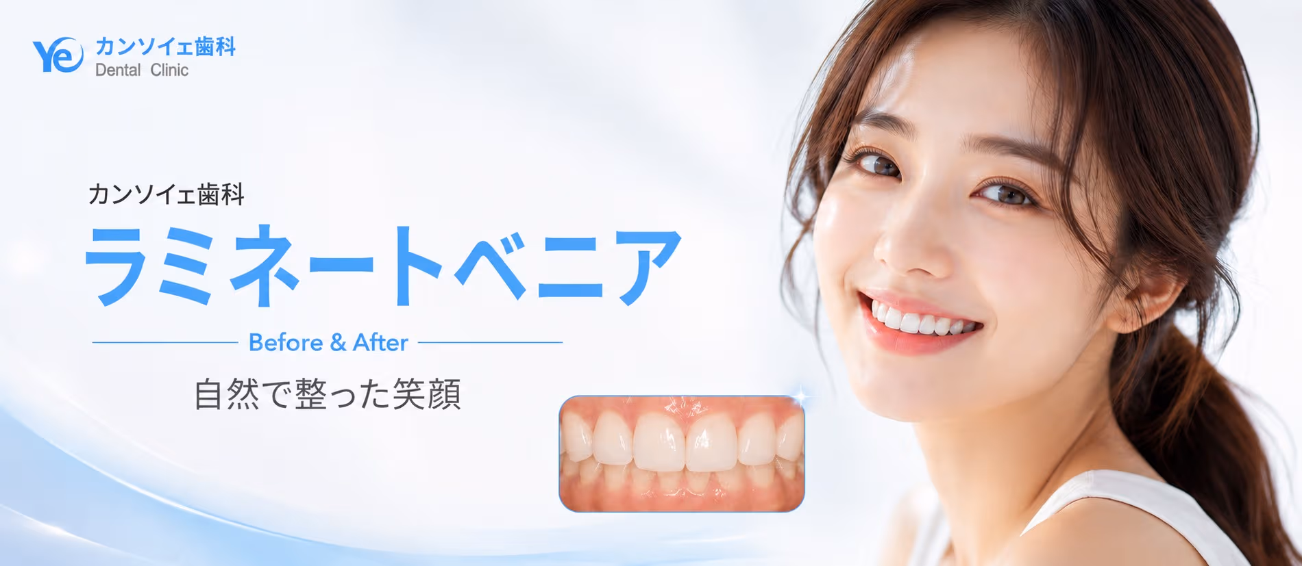 ラミネート