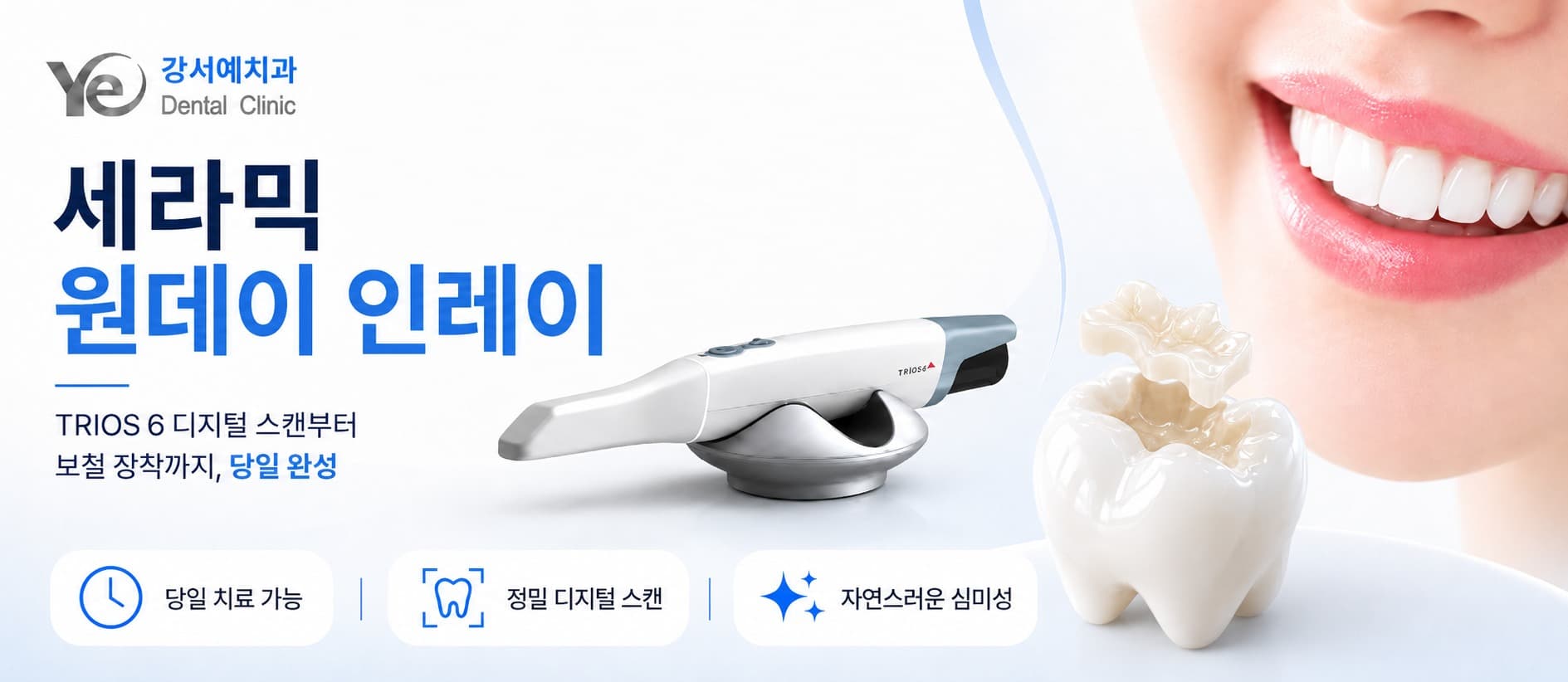 세라믹 원데이 인레이