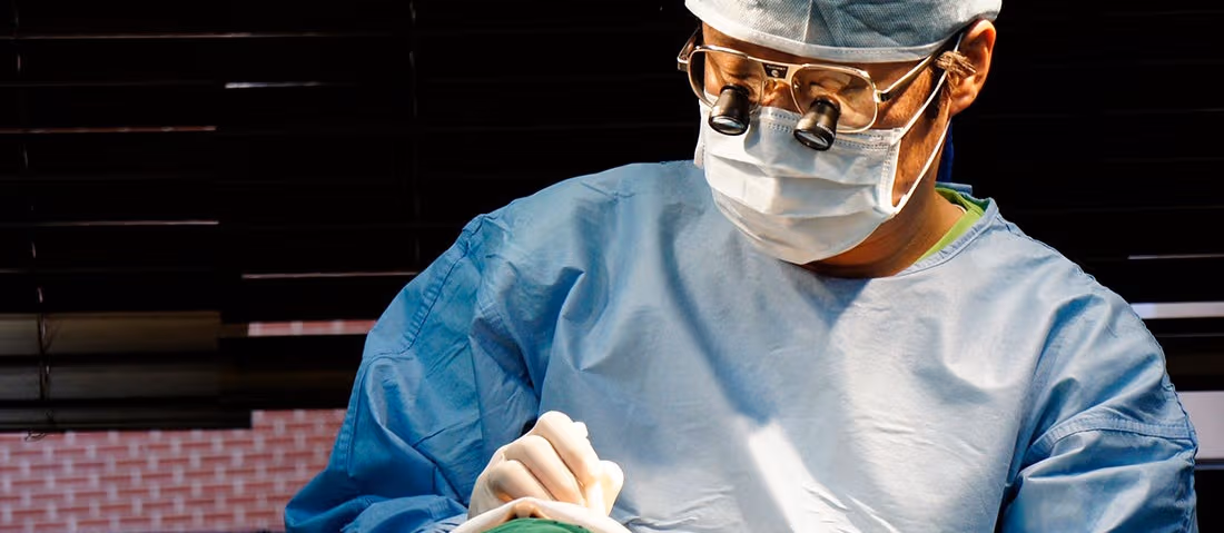 Follicular Unit Extraction (FUE) Hair transplant