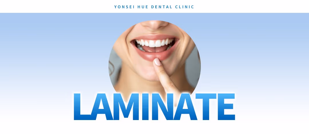 Laminate