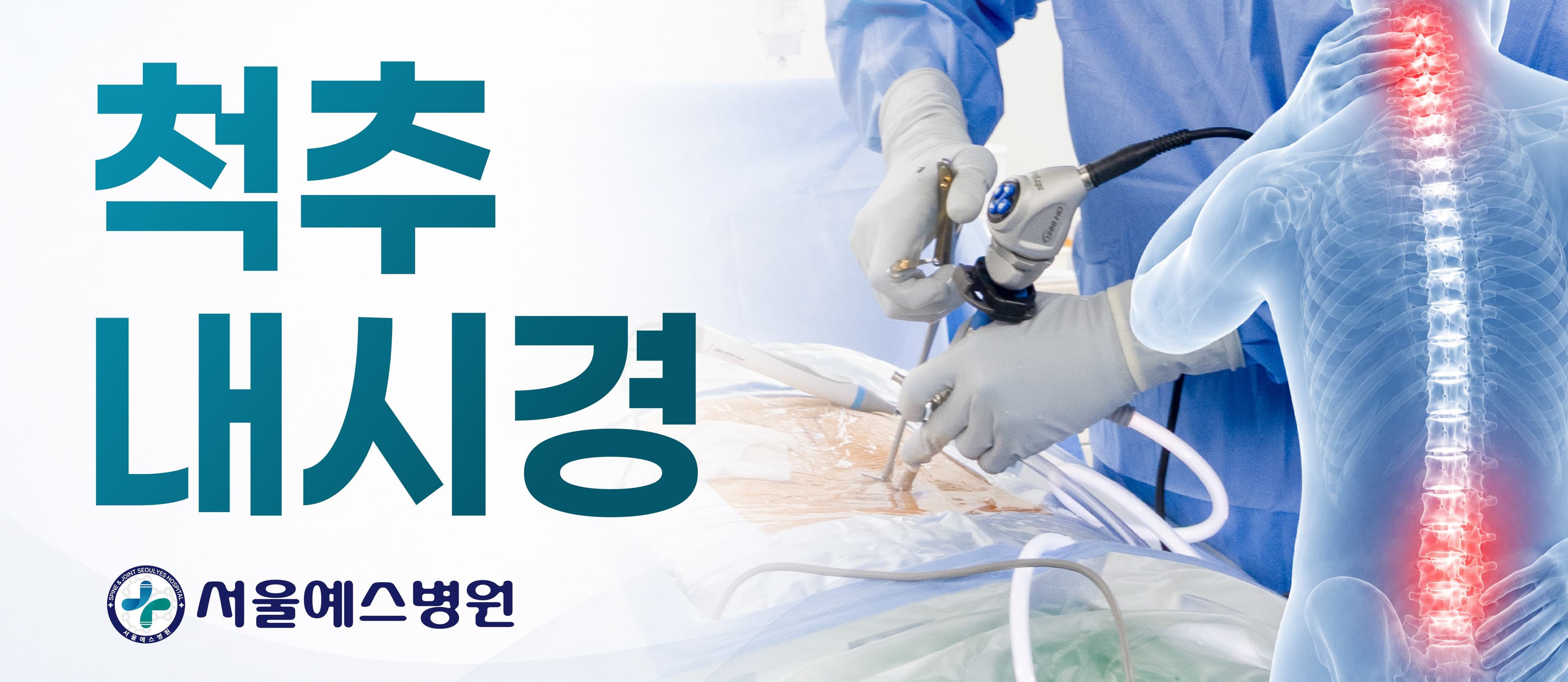 척추내시경수술