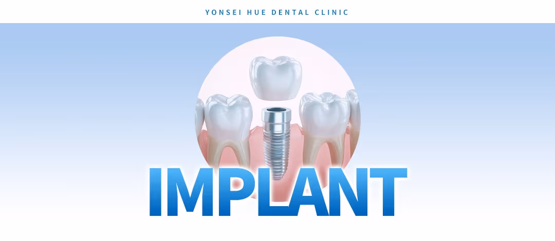 Dental implant
