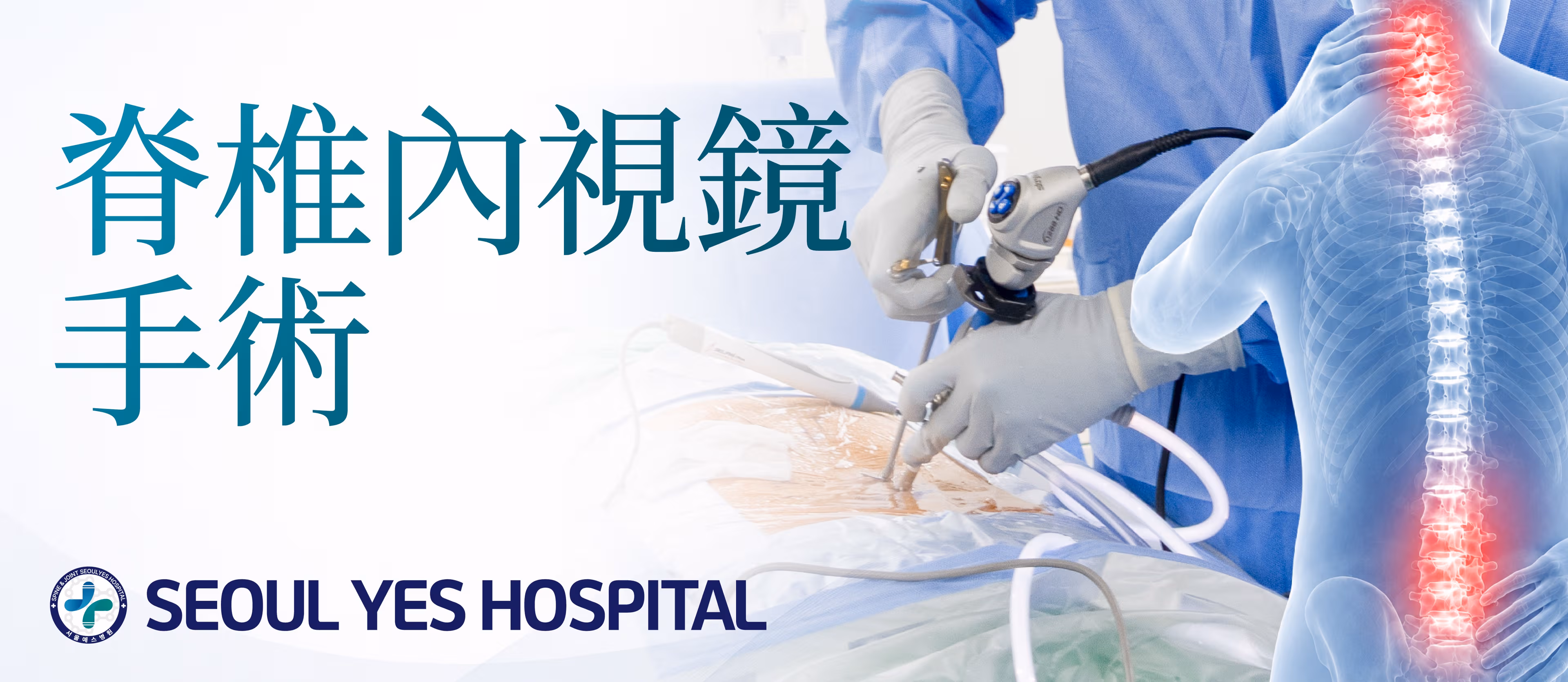 脊椎內視鏡手術