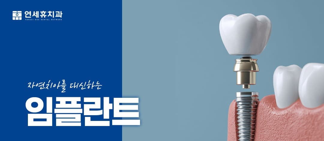 임플란트